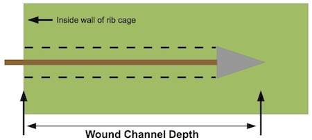 <b>Figure B-2. Depth of wound channel.</b> The critical part of the wound channel lies entirely within the thoracic cavity.